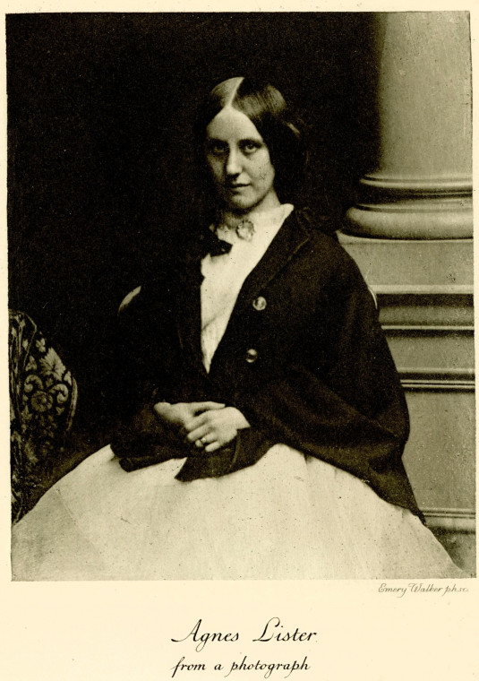 Agnes Lister from a photograph taken about 1856 Copyright: Lord Lister by R J Godlee 1918