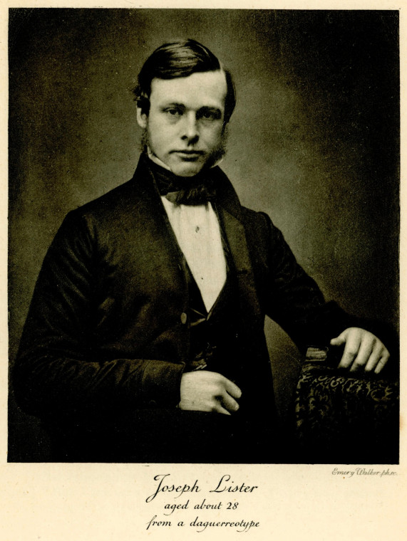 Joseph Lister 1827 to 1912  Aged About 28 Copyright: Lord Lister by R J Godlee 1918