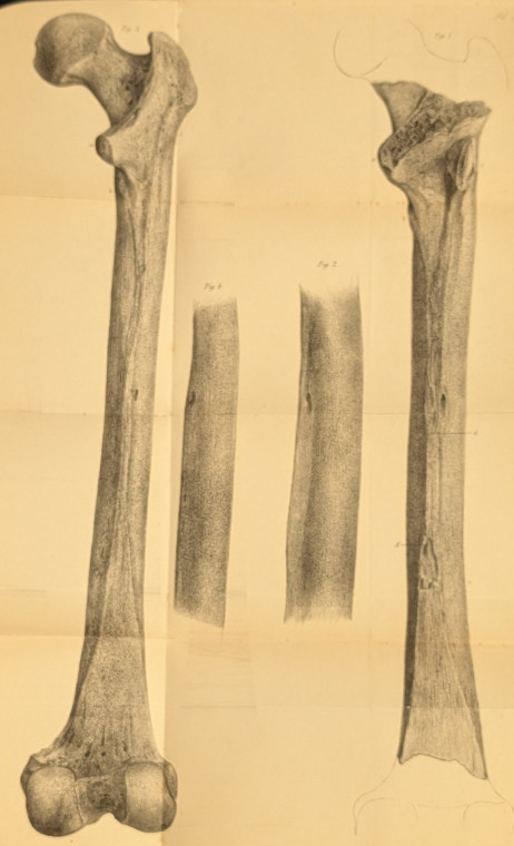 Tilbury Man Leg Bones Owen 1884 Copyright: Richard Owen Antiquity of Man 1884