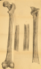 Tilbury Man Leg Bones Owen 1884 