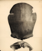 Tilbury Man Skull Owen 1884 