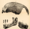 Tilbury Man Skull and Jaw Owen 1884