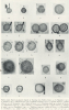 Pollen Grains 1  Nazeing Late Glacial 